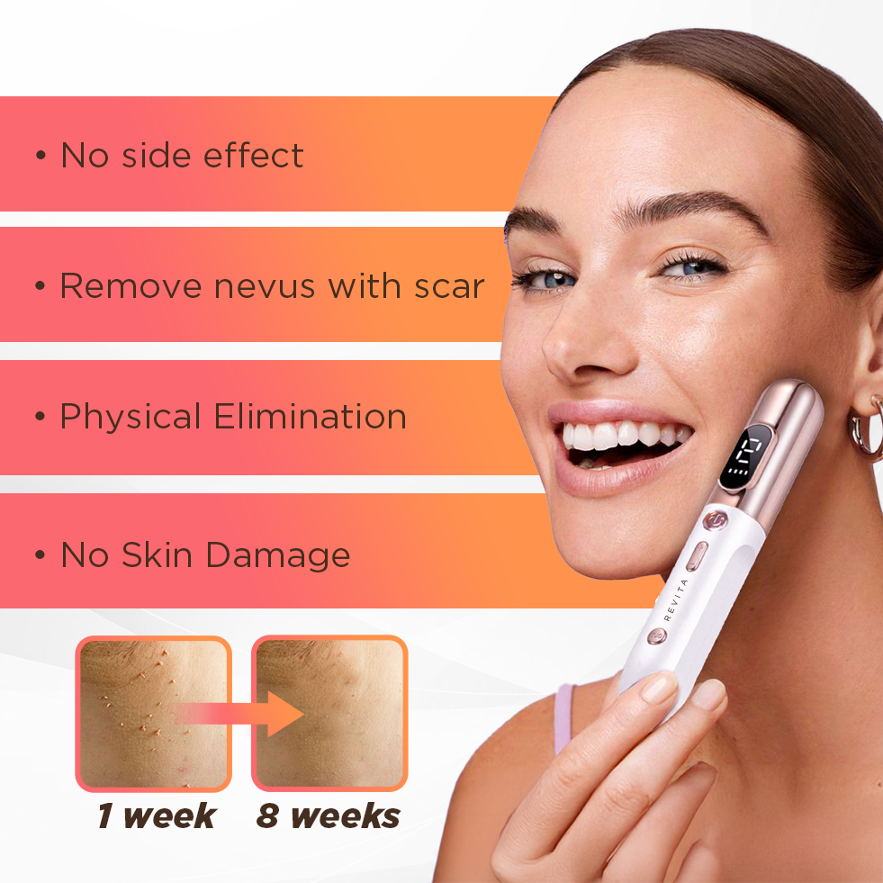 Revita - Moles, Freckles, Skin Tags and Spots Remover